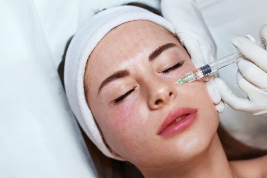 Quy trình tiêm mesotherapy gồm 4 bước chuẩn y khoa