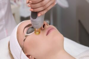 Công dụng của laser trong điều trị và chăm sóc da